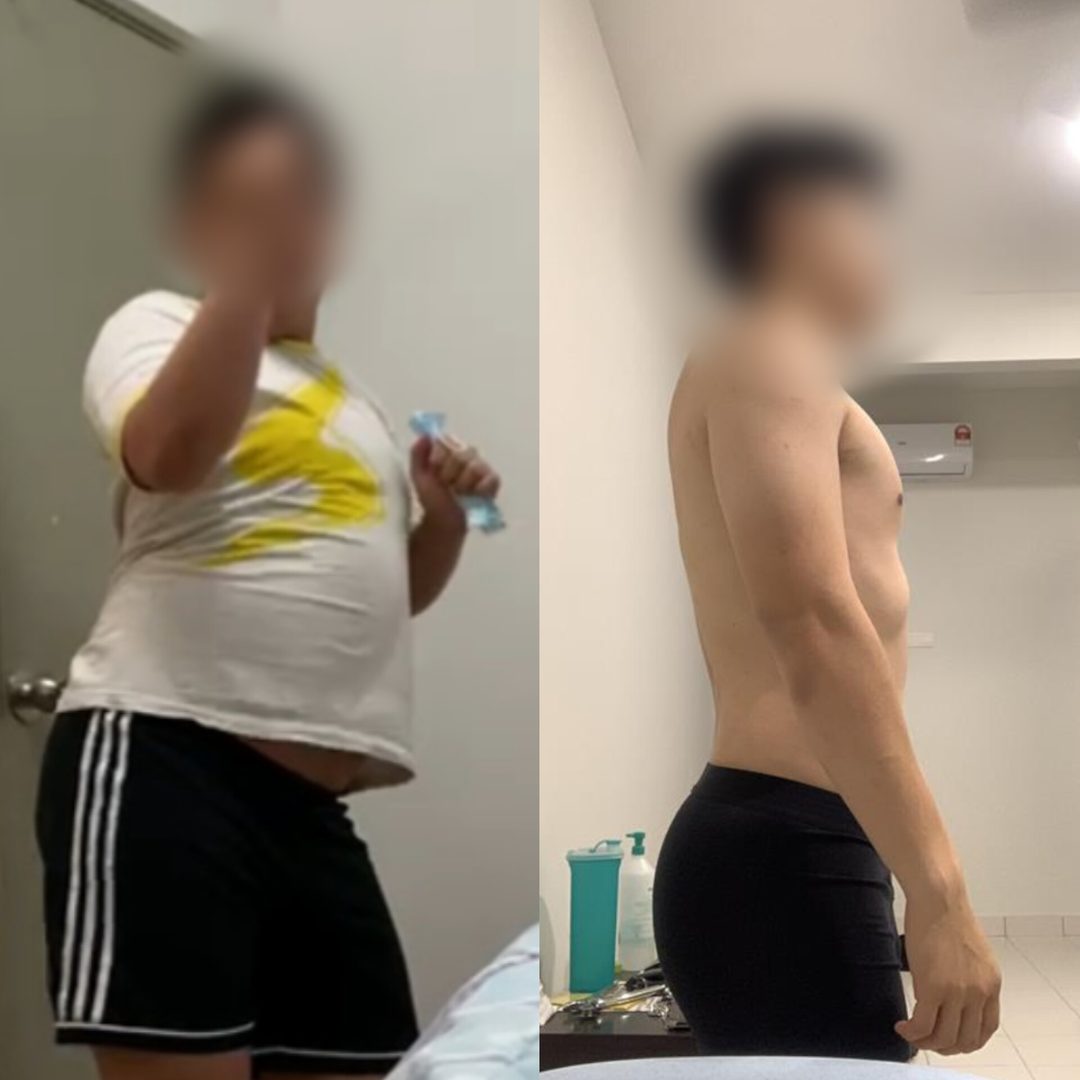 John before and after, side view, faces blurred at his request