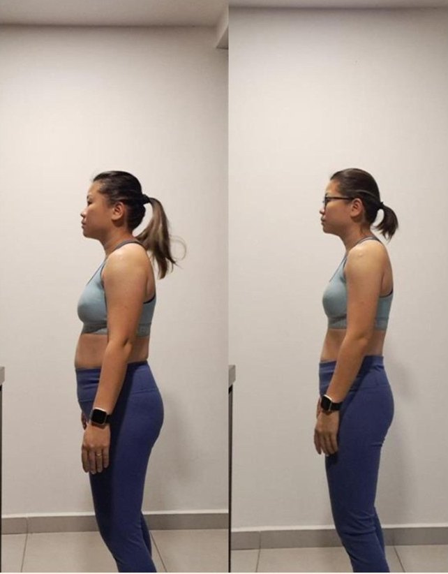 Rachel, side view before and after